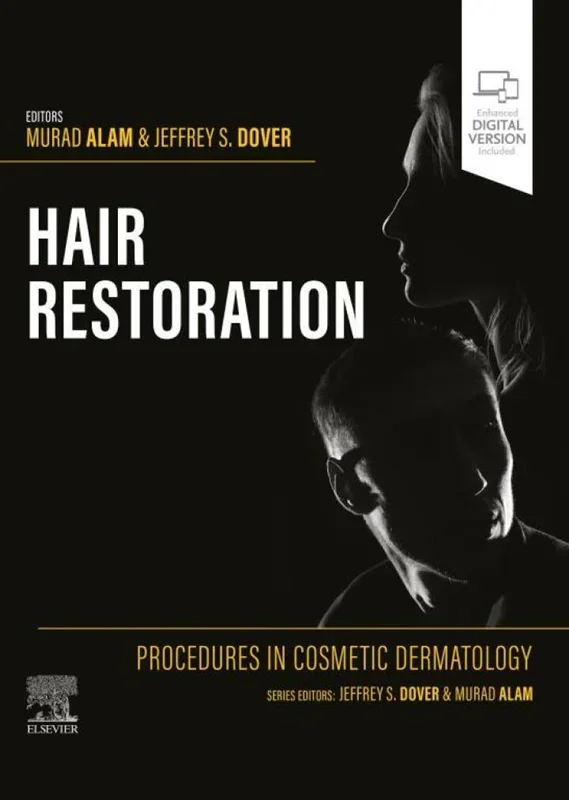 Procedures in Cosmetic Dermatology: Hair Restoration