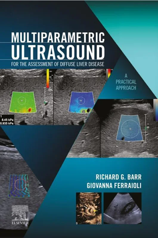Multiparametric Ultrasound for the Assessment of Diffuse Liver Disease: A Practical Approach