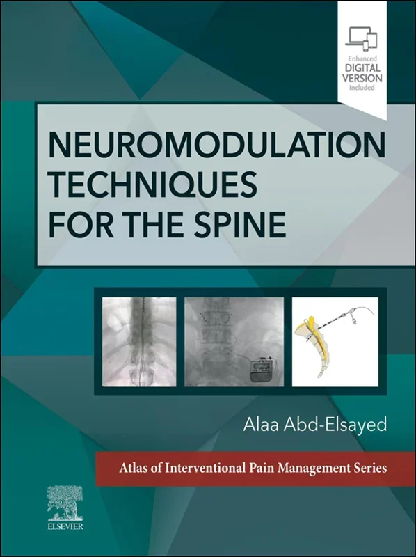 Neuromodulation Techniques for the Spine: A Volume in the Atlas of Interventional Pain Management Series