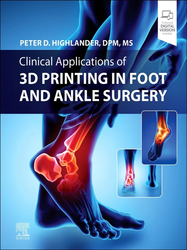 Clinical Application of 3D Printing in Foot & Ankle Surgery
